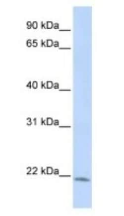 LIN7C Antibody, Novus Biologicals 0.05mg; Unlabeled:Antibodies, Polyclonal