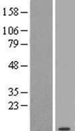 Novus Biologicals&trade;&nbsp;LINC00152 Overexpression Lysate