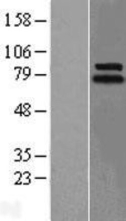 Novus Biologicals&trade;&nbsp;LINGO-1 Overexpression Lysate