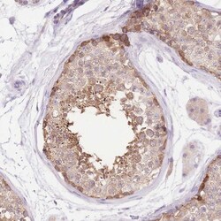 LIPH Antibody, Novus Biologicals 0.1mL; Unlabeled:Antibodies, Polyclonal