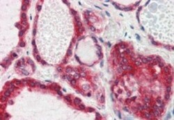 Lipin 3 Antibody, Novus Biologicals 0.1mg; Unlabeled:Antibodies, Polyclonal