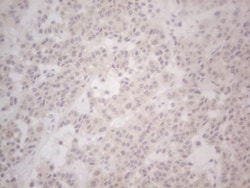 Lipin 1 Antibody (OTI5B5), Novus Biologicals 0.1mL; Unlabeled:Antibodies,