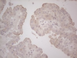 Lipin 1 Antibody (OTI5B5), Novus Biologicals 0.1mL; Unlabeled:Antibodies,