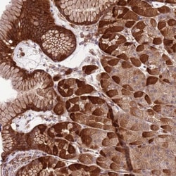Lipin 2 Antibody, Novus Biologicals:Antibodies:Primary Antibodies