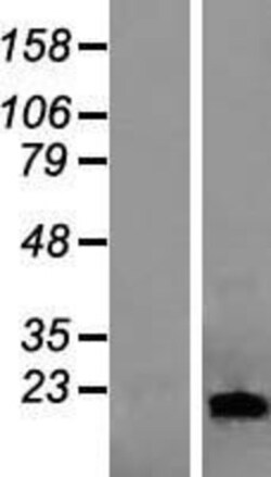 Novus Biologicals™ Lipocalin-1 Overexpression Lysate