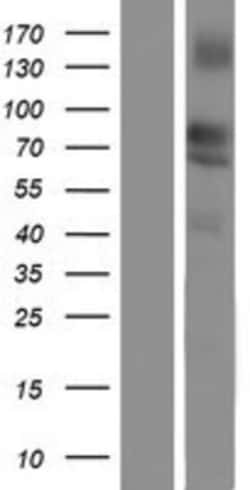 Novus Biologicals™ Lipolysis Stimulated Lipoprotein Receptor Overexpression Lysate
