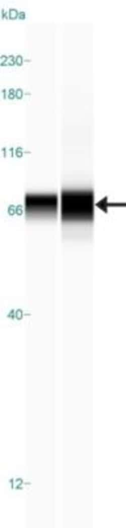 Lipolysis Stimulated Lipoprotein Receptor Antibody, Novus Biologicals:Antibodies:Primary