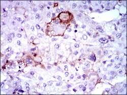 Lipoprotein a Antibody (4H1) - BSA Free, Novus Biologicals:Antibodies:Primary