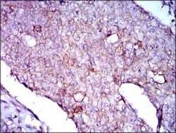 Lipoprotein a Antibody (4H1) - BSA Free, Novus Biologicals:Antibodies:Primary