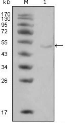 Lipoprotein Lipase/LPL Antibody (2C5), Novus Biologicals 0.025 mL, Unconjugated:Antibodies,