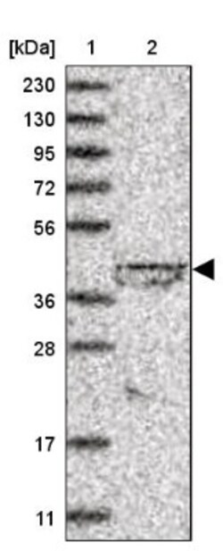 lipoyltransferase 1 Antibody, Novus Biologicals 0.1mL; Unlabeled:Antibodies,
