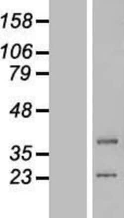 Novus Biologicals&trade;&nbsp;lipoyltransferase 1 Overexpression Lysate