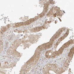 lipoyltransferase 1 Antibody, Novus Biologicals 0.1mL; Unlabeled:Antibodies,