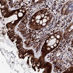 LIPT2 Antibody, Novus Biologicals 0.1mL; Unlabeled:Antibodies, Polyclonal