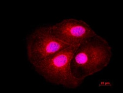 LIS1 Antibody, Novus Biologicals 0.1mL; Unlabeled:Antibodies, Polyclonal