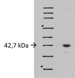 LIS1 Antibody, Novus Biologicals 0.1mL; Unlabeled:Antibodies, Polyclonal