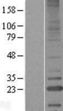 Novus Biologicals&trade;&nbsp;LITAF Overexpression Lysate