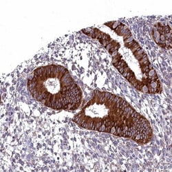 LIV-1/Zip6 Antibody, Novus Biologicals 0.1mL; Unlabeled:Antibodies, Polyclonal