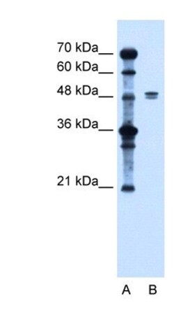 LIV-1/Zip6 Antibody, Novus Biologicals 0.1mg; Unlabeled:Antibodies, Polyclonal