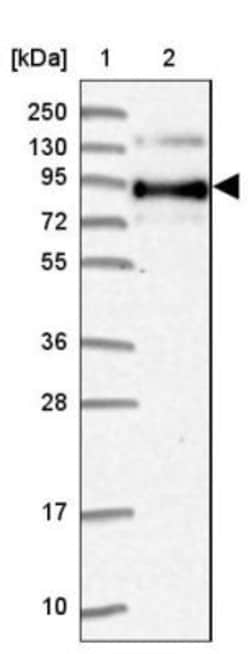 LIV-1/Zip6 Antibody, Novus Biologicals 0.1mL; Unlabeled:Antibodies, Polyclonal
