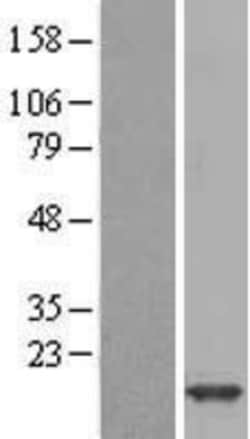 Novus Biologicals&trade;&nbsp;FABP1/L-FABP Overexpression Lysate