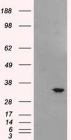 Livin Antibody (OTI1D12), Novus Biologicals 0.1mL; Unlabeled:Antibodies,