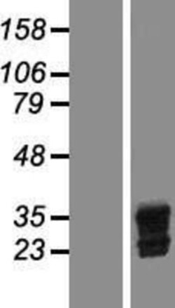 Novus Biologicals™ Livin Overexpression Lysate