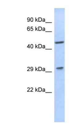 LIX1 Antibody, Novus Biologicals 100&mu;L; Unlabeled:Antibodies, Polyclonal