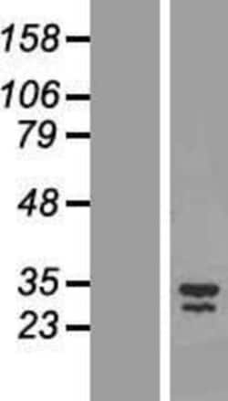 Novus Biologicals&trade;&nbsp;LIX1 Overexpression Lysate