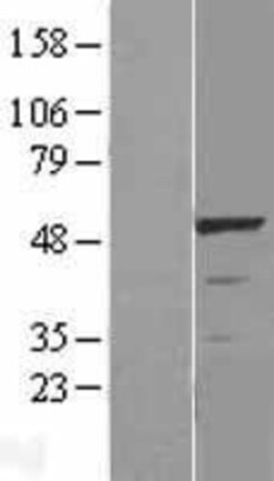 Novus Biologicals&trade;&nbsp;LKB1/STK11 Overexpression Lysate