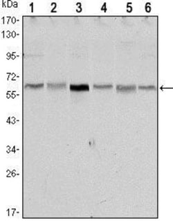 LKB1/STK11 Antibody (4H12), Novus Biologicals 0.025 mL, Unconjugated:Anticuerpos