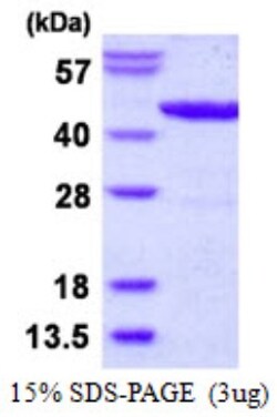 Novus Biologicals&trade;&nbsp;Recombinant E. coli lldD His Protein