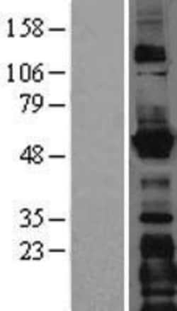 Novus Biologicals&trade;&nbsp;LMAN1 Overexpression Lysate