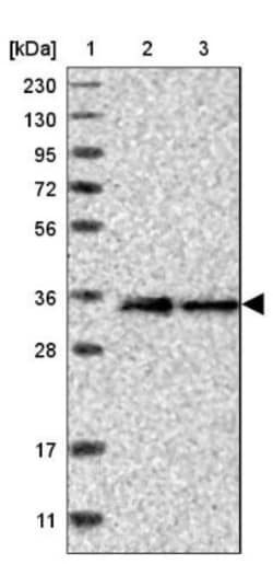 LMAN2L Antibody, Novus Biologicals 0.1mL; Unlabeled:Antibodies, Polyclonal