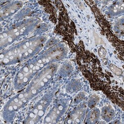 LMBR1 Antibody, Novus Biologicals 0.1mL; Unlabeled:Antibodies, Polyclonal