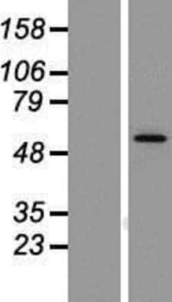 Novus Biologicals™ LMBR1L Overexpression Lysate