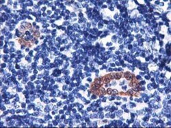 LMCD1 Antibody (OTI1H5), Novus Biologicals 0.1mL; Unlabeled:Antibodies,