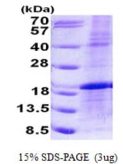 Novus Biologicals&trade;&nbsp;Recombinant Human LMO1 His Protein