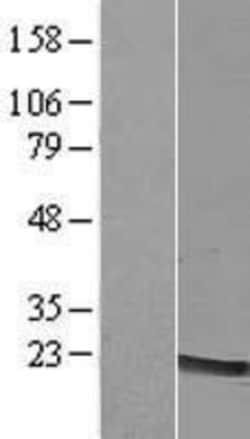 Novus Biologicals&trade;&nbsp;LMO2 Overexpression Lysate