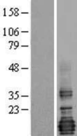 Novus Biologicals&trade;&nbsp;LMO4 Overexpression Lysate