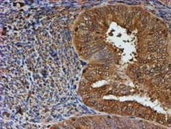 LMP2/PSMB9 Antibody (OTI1D1), Novus Biologicals 0.1mL; Unlabeled:Antibodies,