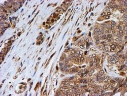 LMP2/PSMB9 Antibody (OTI1D1), Novus Biologicals 0.1mL; Unlabeled:Antibodies,