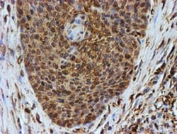 LMP2/PSMB9 Antibody (OTI1D1), Novus Biologicals 0.1mL; Unlabeled:Antibodies,