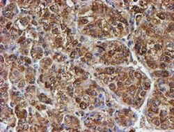 LMP2/PSMB9 Antibody (OTI1D1), Novus Biologicals 0.1mL; Unlabeled:Antibodies,