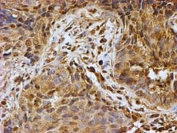 LMP2/PSMB9 Antibody (OTI1D1), Novus Biologicals 0.1mL; Unlabeled:Antibodies,
