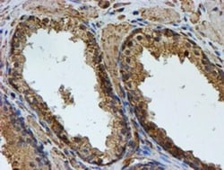 LMP2/PSMB9 Antibody (OTI1D1), Novus Biologicals 0.1mL; Unlabeled:Antibodies,