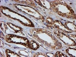 LMP2/PSMB9 Antibody (OTI1D1), Novus Biologicals 0.1mL; Unlabeled:Antibodies,