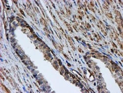 LMP2/PSMB9 Antibody (OTI1D1), Novus Biologicals 0.1mL; Unlabeled:Antibodies,