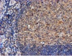 LMP2/PSMB9 Antibody (OTI1D1), Novus Biologicals 0.1mL; Unlabeled:Antibodies,