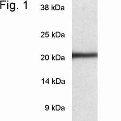 LMP7/PSMB8 Antibody, Novus Biologicals 0.1mg; Unlabeled:Antibodies, Polyclonal